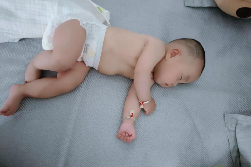 开原六个月宝宝眼睛散光